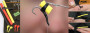Rovnátka EDGES Zig Aligna